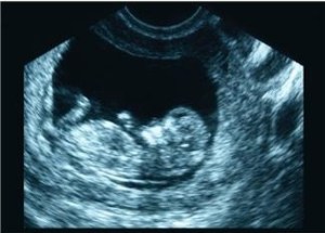 Unborn Baby
